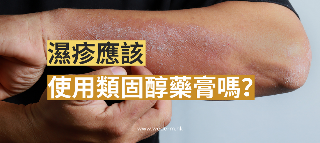 濕疹應該使用類固醇藥膏嗎?一文完整了解類固醇種類、強度、功效