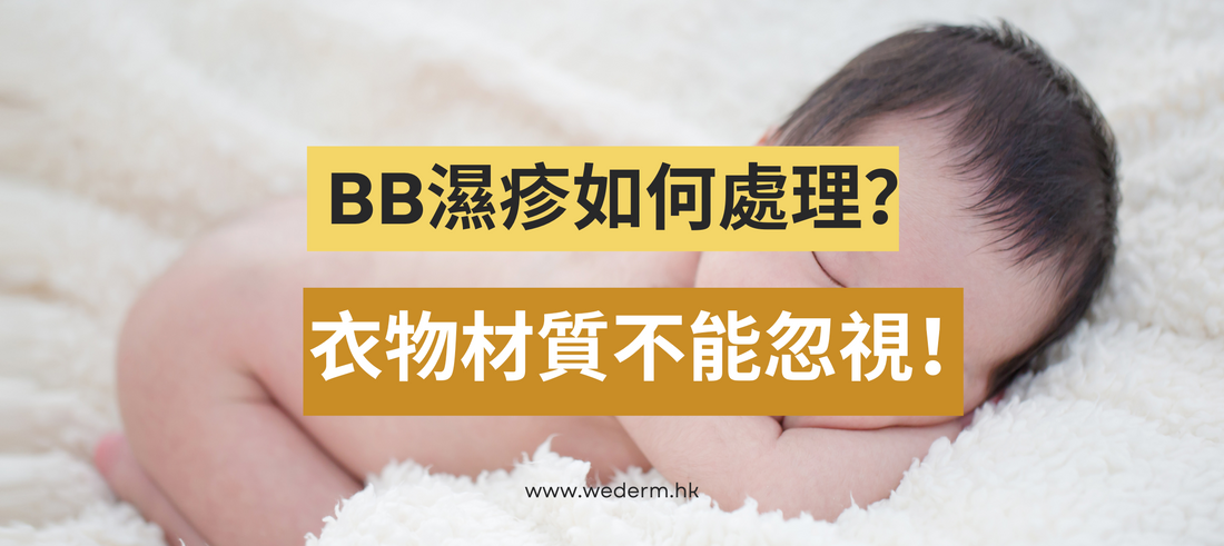 BB濕疹如何處理？衣物材質不能忽視！