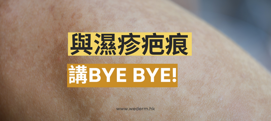 與濕疹疤痕講bye bye!