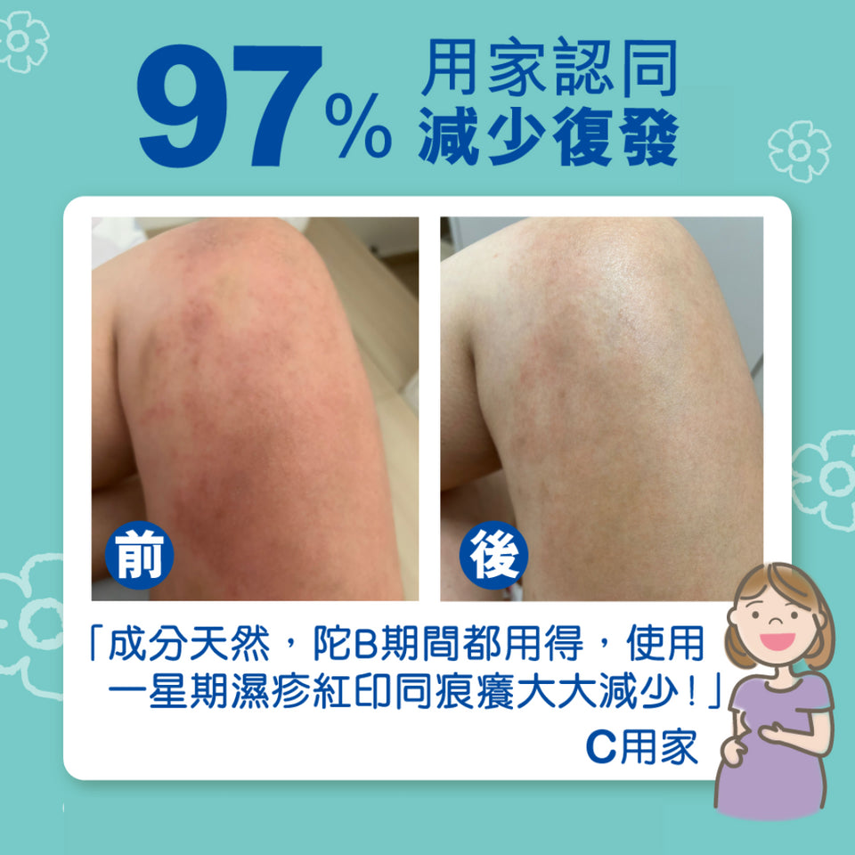 【法國 Mustela】Stelatopia+ 特强止痕補脂潤膚膏 Anti-Itching Lipid-Replenishing Cream 300ml - 醫護獨家