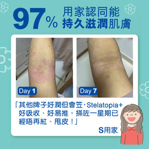 【法國 Mustela】Stelatopia+ 特强止痕補脂潤膚膏 Anti-Itching Lipid-Replenishing Cream 300ml - 醫護獨家