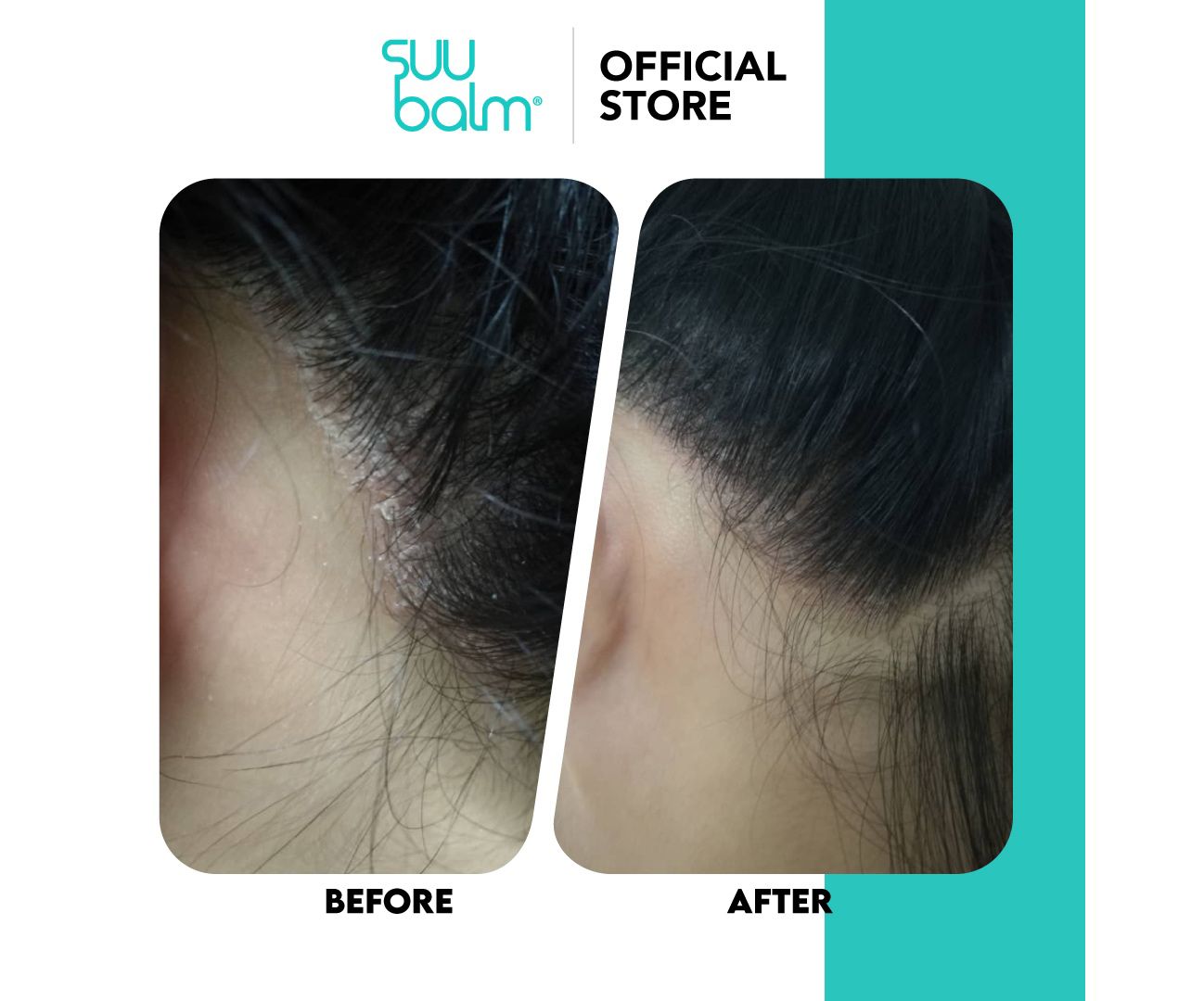 【Suu Balm】 速效舒敏抗屑洗髮乳 Fast-Acting Soothing Anti-Dandruff Shampoo 480ml