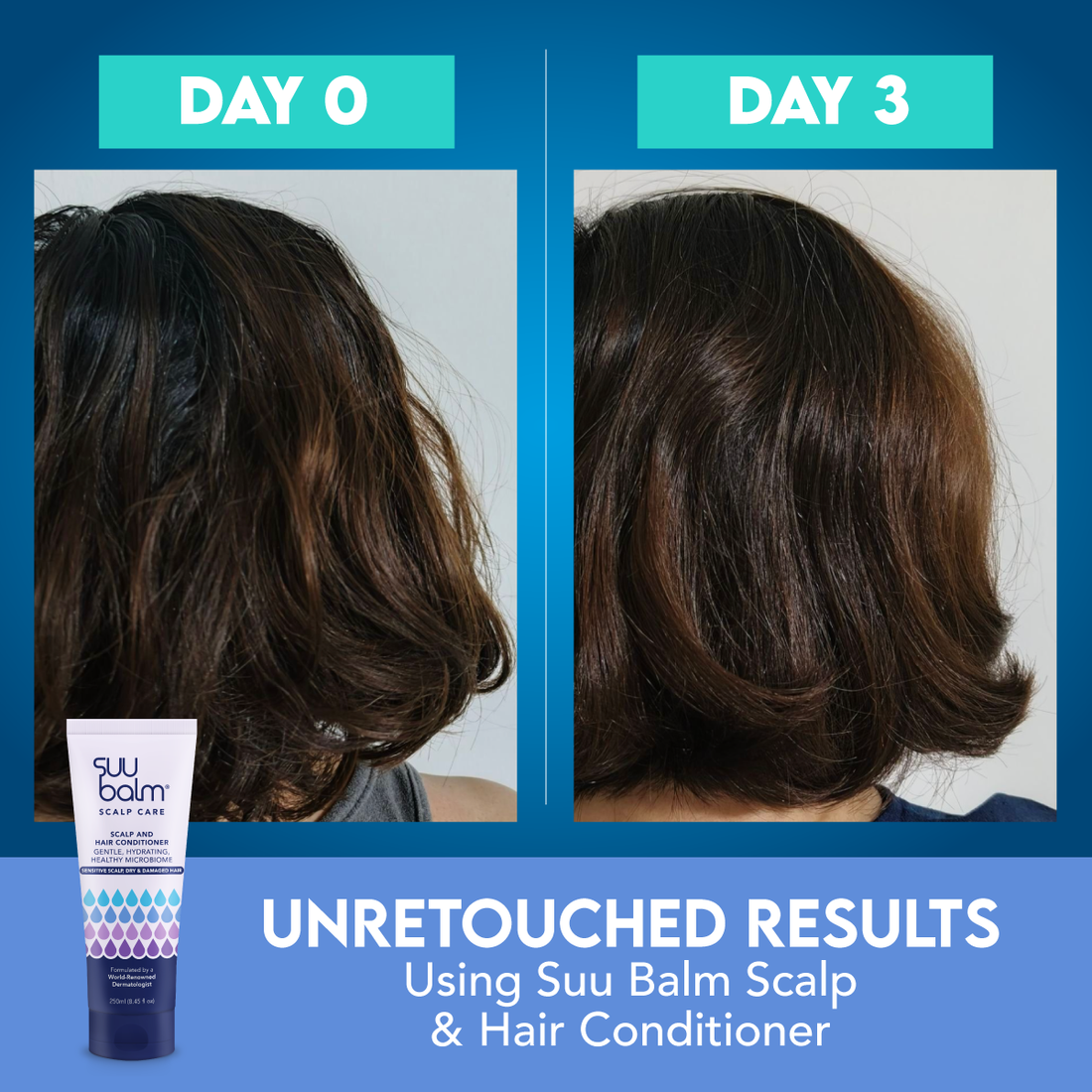 【Suu Balm】 速效舒敏頭皮護髮素 Scalp and Hair Conditioner 250ml