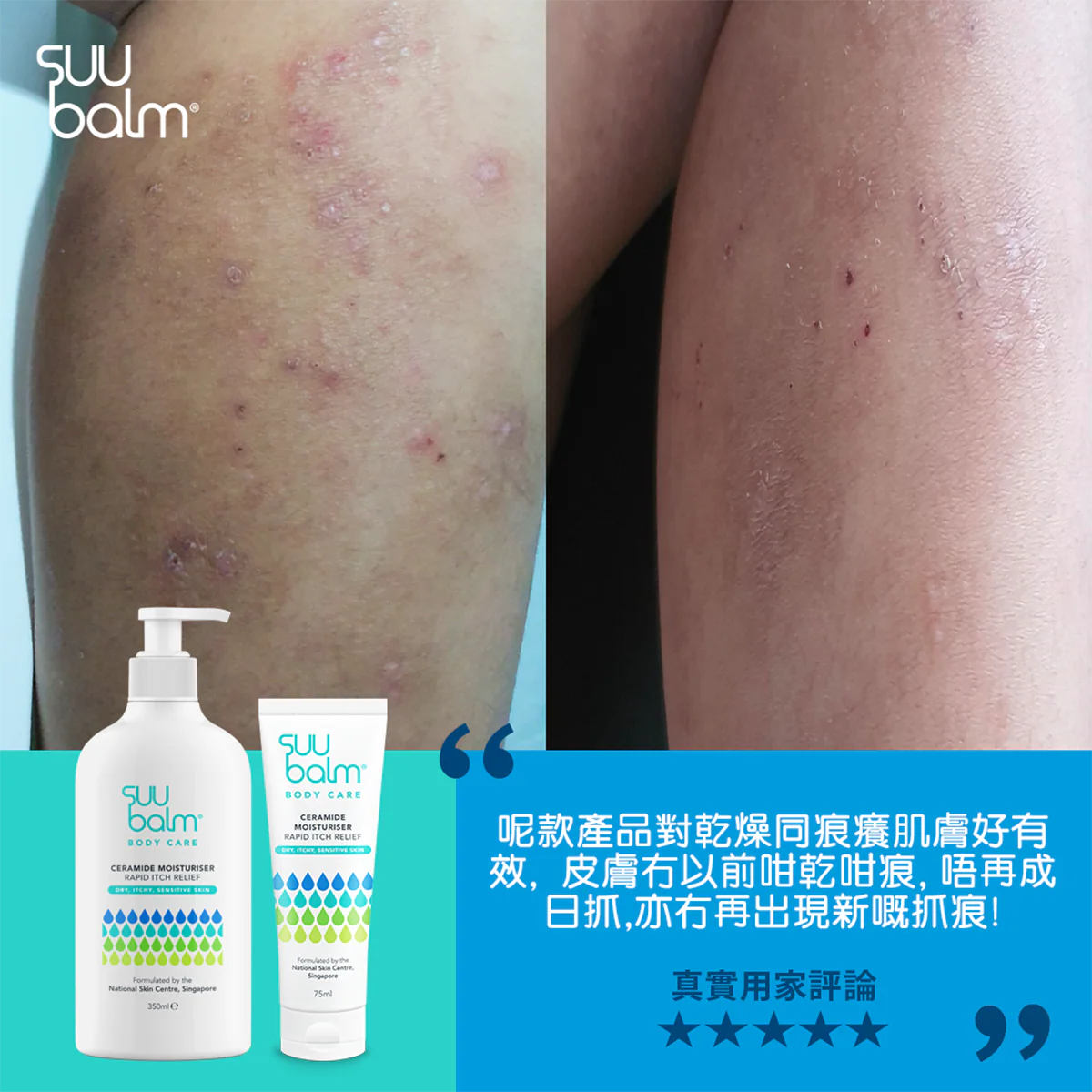 【Suu Balm】 速效舒敏保濕乳 Fast-Acting Soothing Moisturiser 75ml/350ml