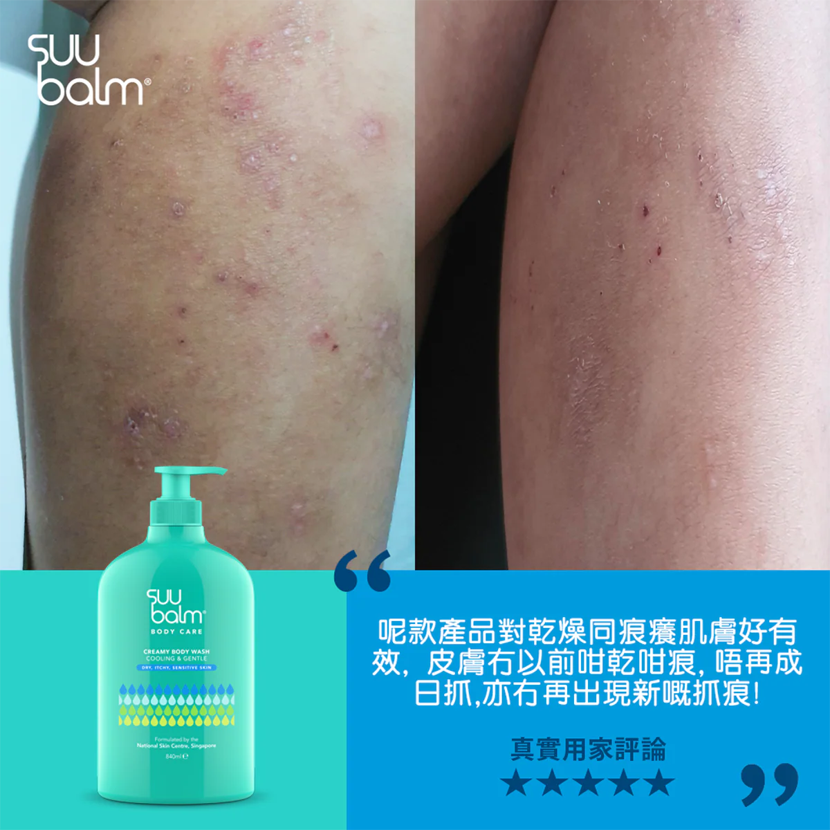 【Suu Balm】 速效舒敏沐浴露 Instant Soothing Body Wash 420ml/840ml