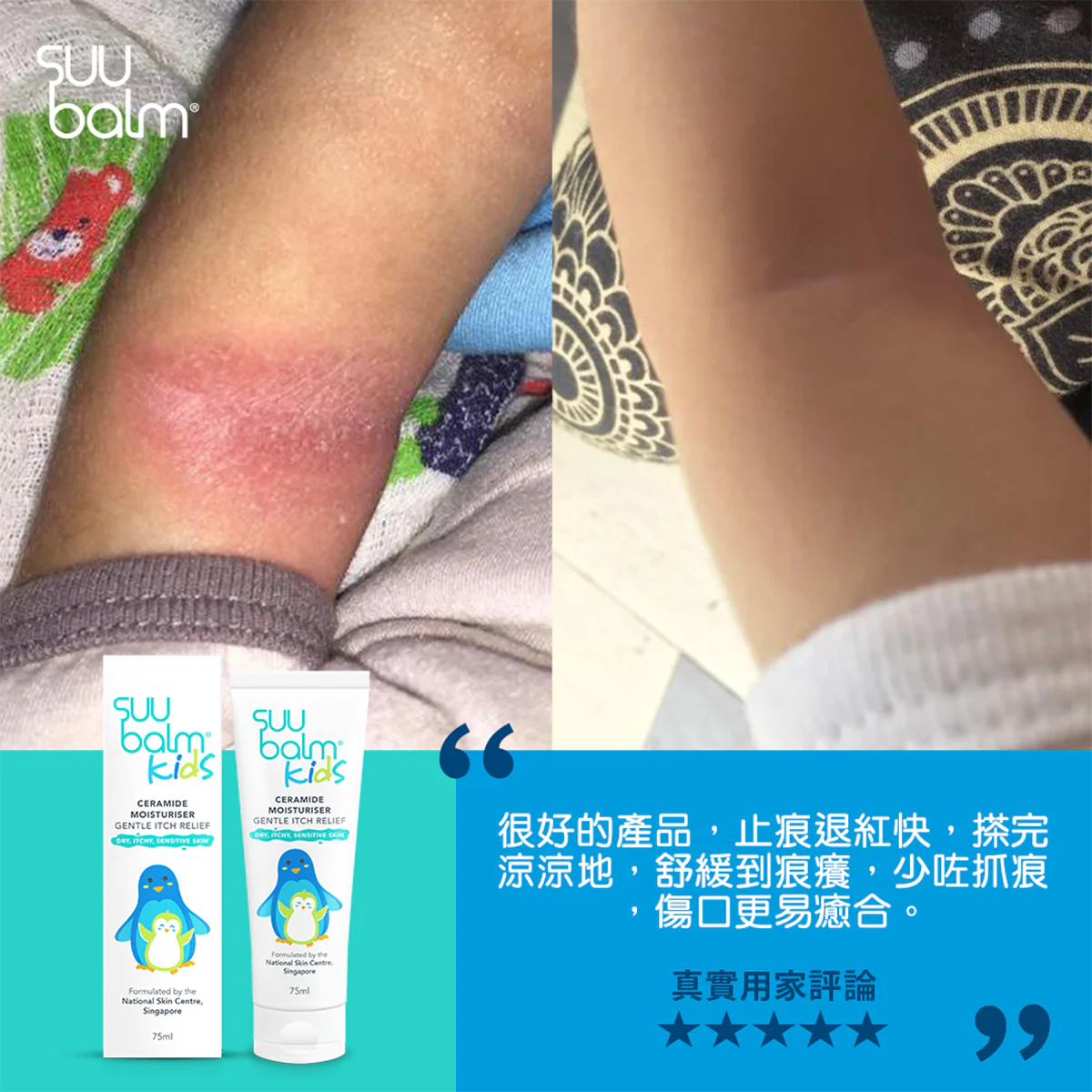 【Suu Balm】 速效舒敏保濕乳 (嬰幼兒配方) Fast-Acting Soothing Moisturiser (Infant Formula) 75ml/200ml