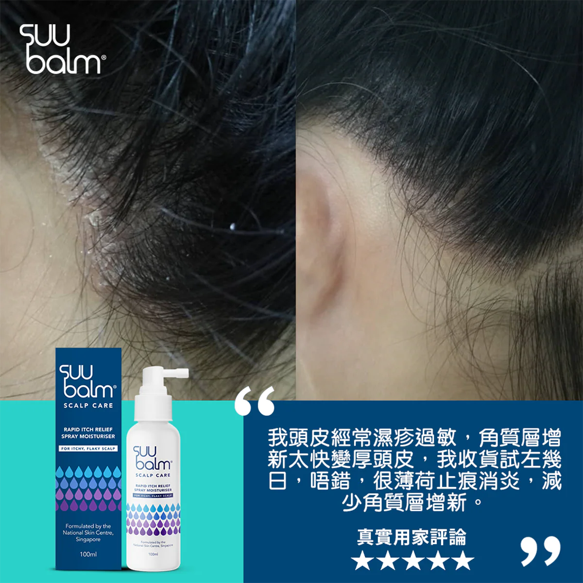 【Suu Balm】 速效舒敏頭皮保濕噴霧 Fast-Acting Soothing Scalp Moisturizing Mist 100ml