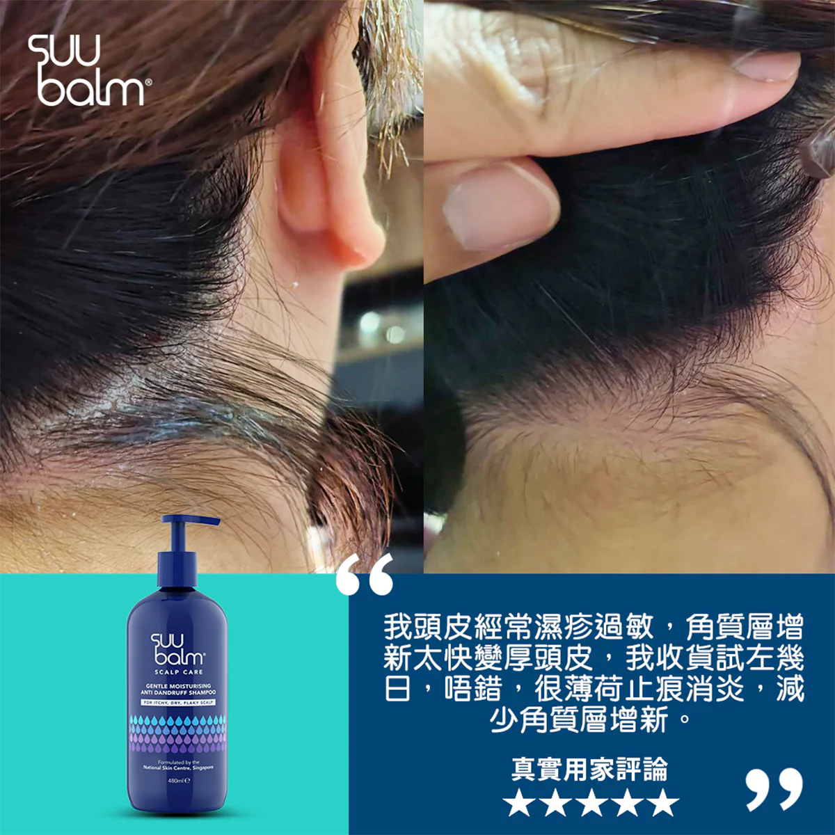 【Suu Balm】 速效舒敏抗屑洗髮乳 Fast-Acting Soothing Anti-Dandruff Shampoo 480ml