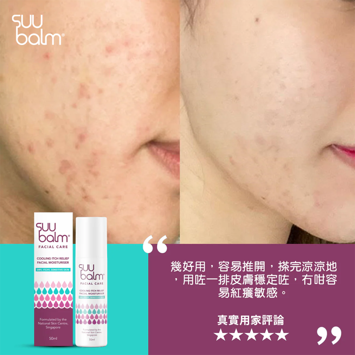 【Suu Balm】 速效舒敏修護面霜 Fast-Acting Soothing Repair Cream 50ml