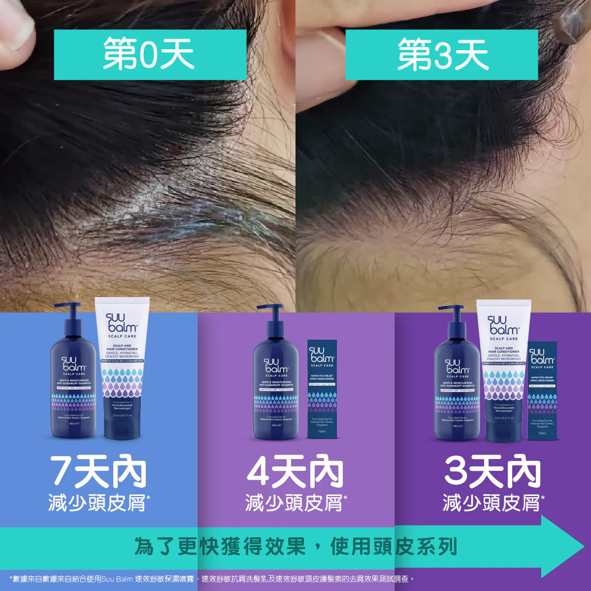 【Suu Balm】 速效舒敏頭皮護髮素 Scalp and Hair Conditioner 250ml