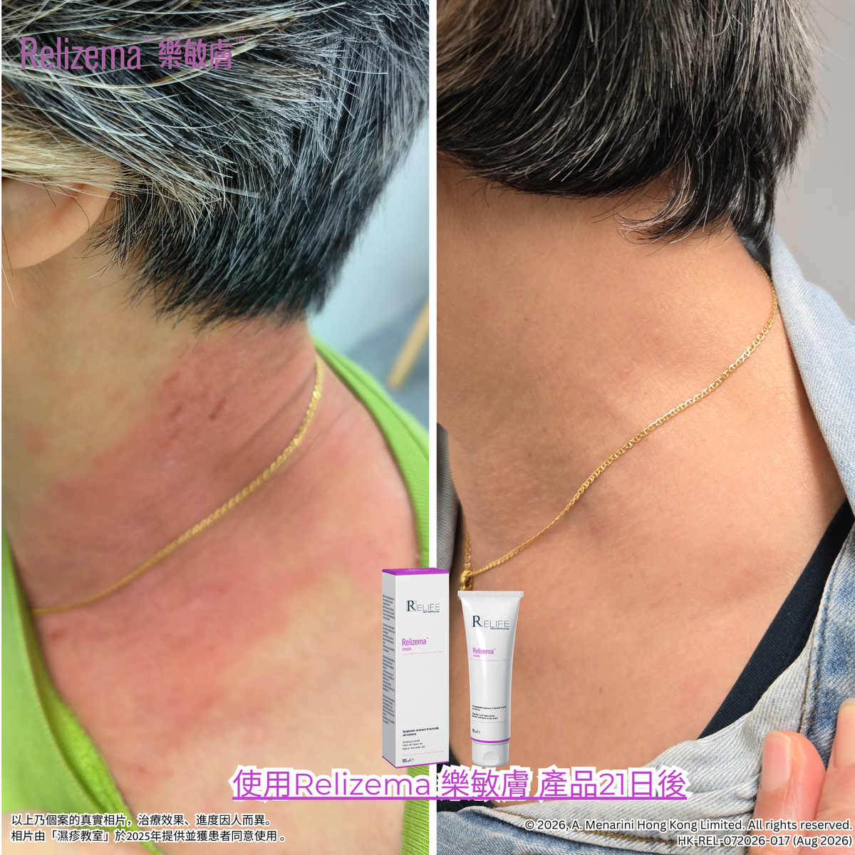 【Relizema 樂敏膚】抗氧治療濕疹症狀潤膚膏100亳升 RELIFE Relizema 100 ml  [官方正貨]