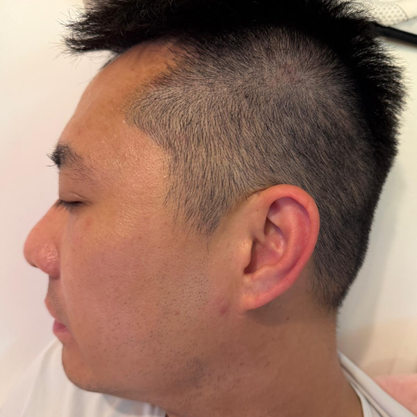 後