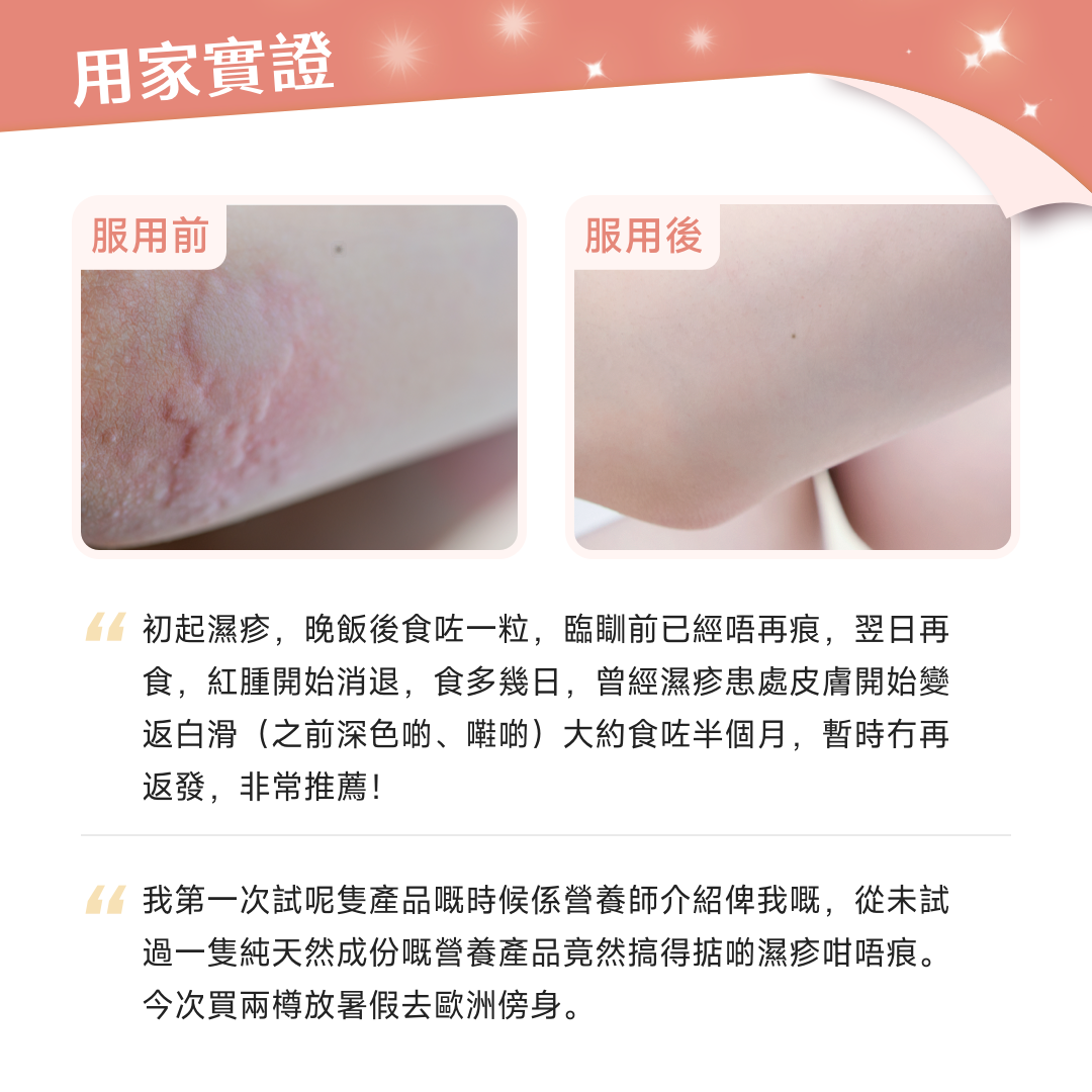 【包裝升級】NatureU 顏 DAOMaster® 高分子VD+舒敏益生菌 抗組胺舒敏片 Hista Dissolve 30粒/瓶